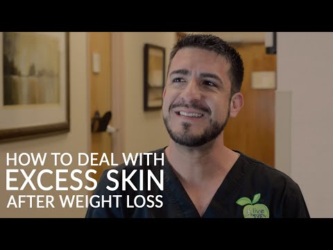 EXCESS SKIN | How to Deal with Loose Skin after Bariatric Surgery